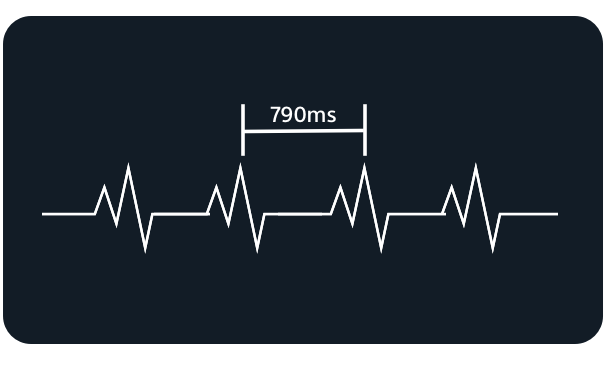 S-ECG signal quality and event review tools