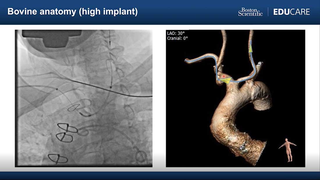 SENTINEL Training Module 2 Thumbnail