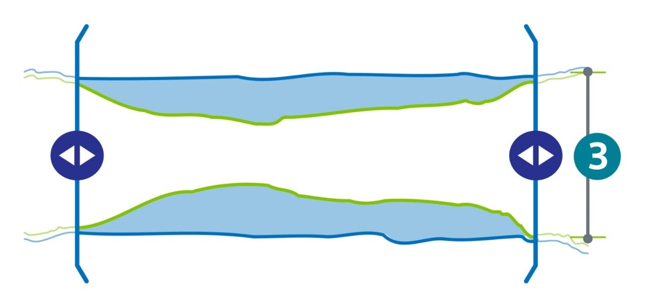 Illustration showing the sideways angle of a lesion and the vessel size