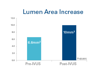 Bar chart of Lumen Area Increase between Pre-IVUS (6.6mm²) and Post-IVUS (10mm²).