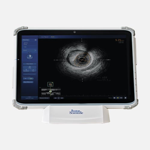 AVVIGO™+ Multi-Modality Guidance System.