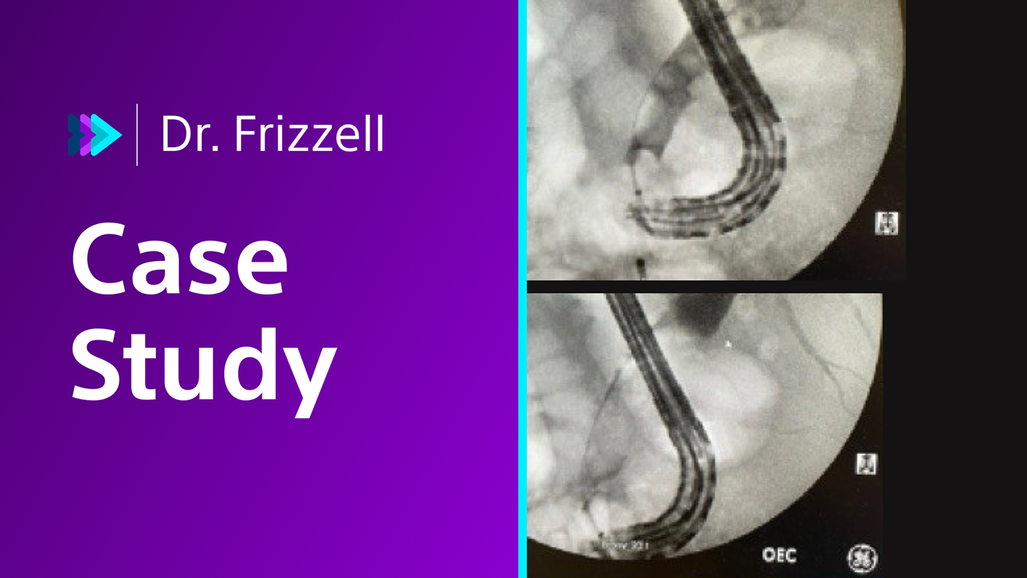 Dr. Frizzell case study.