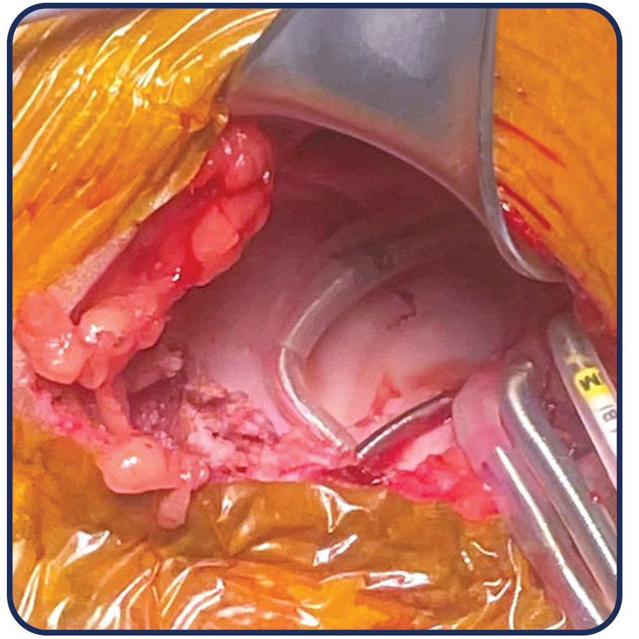 Two BioEnvelope pouches shown side by side in different sizes. 