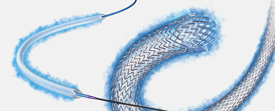 Boston Scientific Ranger Balloon Catheter and Eluvia Vascular Stent System.