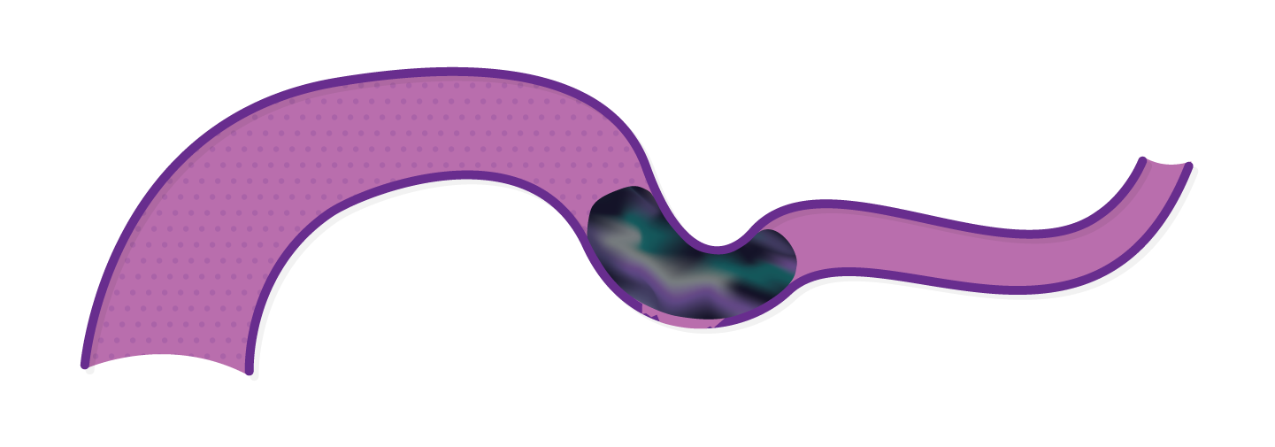 Obsidio conformable fast injection deployment final state.