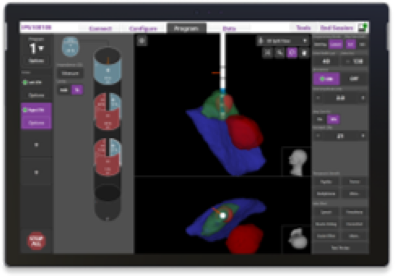 Image guided programming