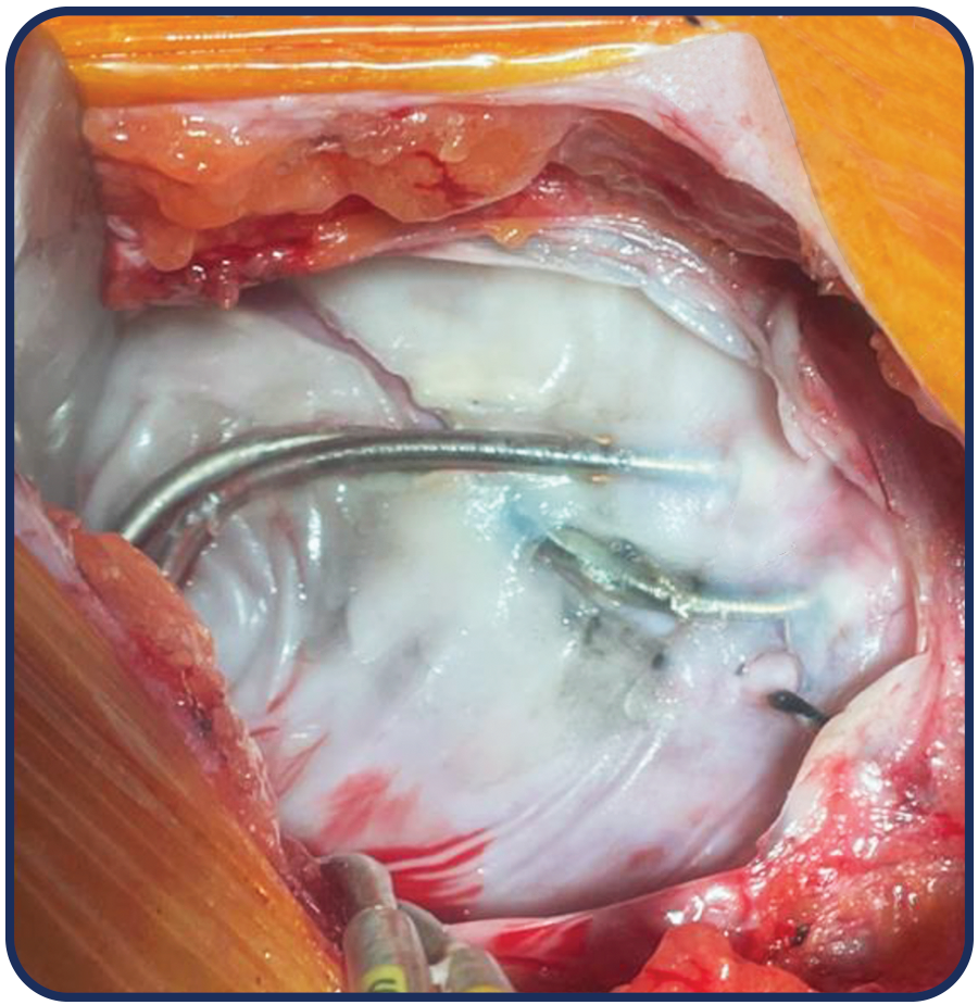 Two BioEnvelope pouches shown side by side in different sizes. 