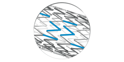 Innova Vascular Stent peak to valley design.