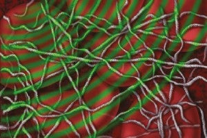 EKOS Ultrasonic energy thins fibrin strands