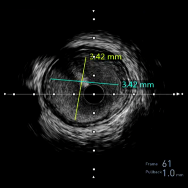 Comprehensive vessel view with precise measurements