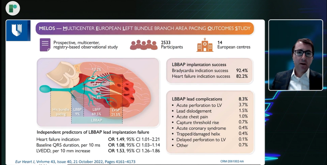 MELOS study slide presenting Left Bundle Branch Area Pacing outcomes and lead complication data.