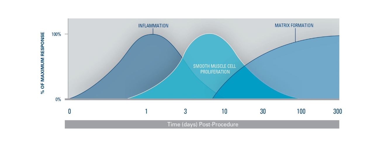 The restenotic cascade: inflammatory, granulation and matrix remodelling