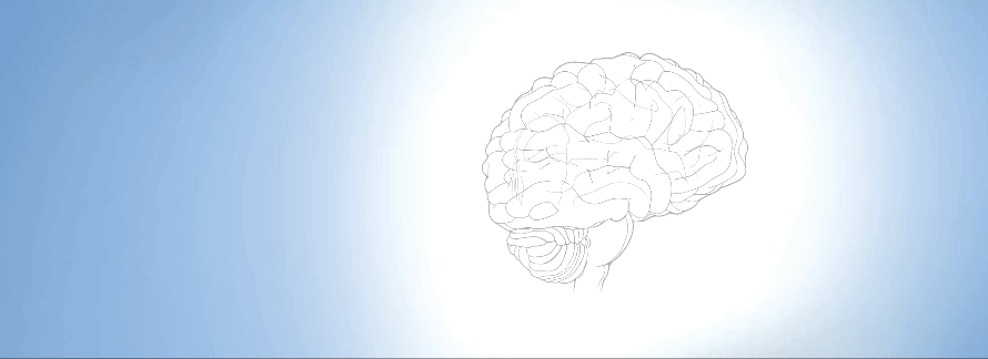 Animiertes Bannerbild, das die direktionale Tiefehirnstimulation zeigt