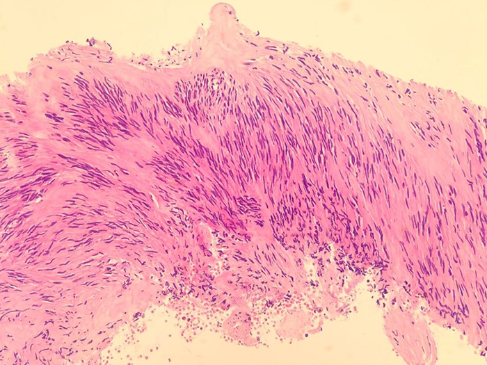Tissue Sample Analysied