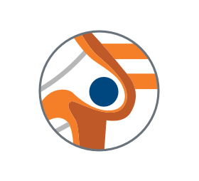 A graphic of a left atrial appendage with a blood clot forming in it.