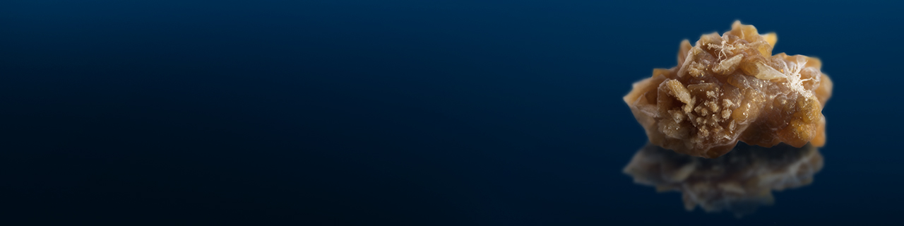 Stein Kalzium Banner