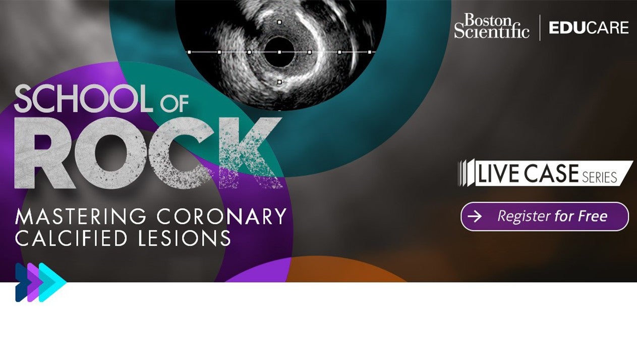 School of Rock Live Case Series 