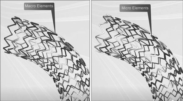 Express LD Iliac and Biliary Stent's Macro and Micro Elements.