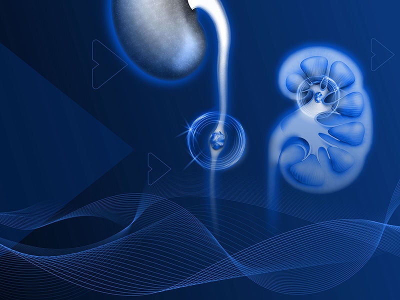 Explore our Laser Portfolio