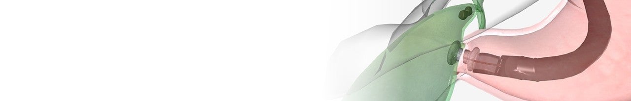 HOT AXIOS Gallbladder Drainage