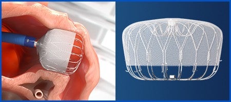 ストラクチャーハート