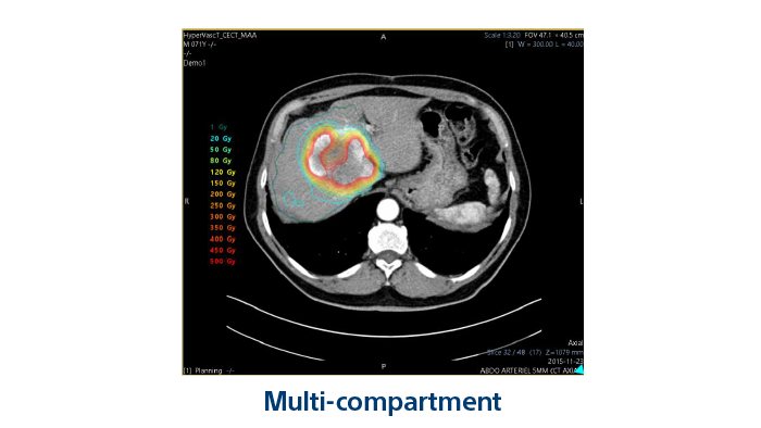 TheraSphere therapy for hepatologists | Boston Scientific - Boston ...