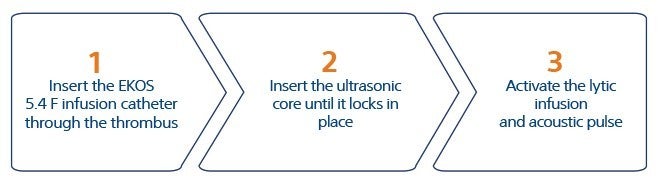 Reduced procedure time