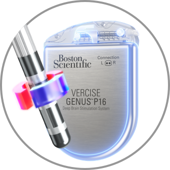 Two graphics showing semi-bipolar stimulation; one with a deep brain stimulation lead with +50% under it and the other with IPG with +50% under it.