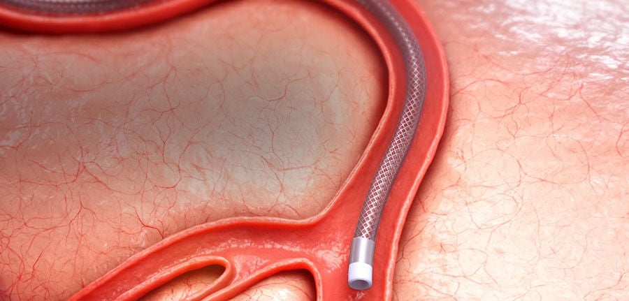 truselect shown curving in animated vein maintaining form.