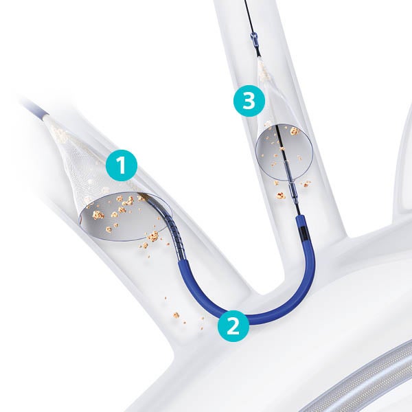 SENTINEL device showing its parts