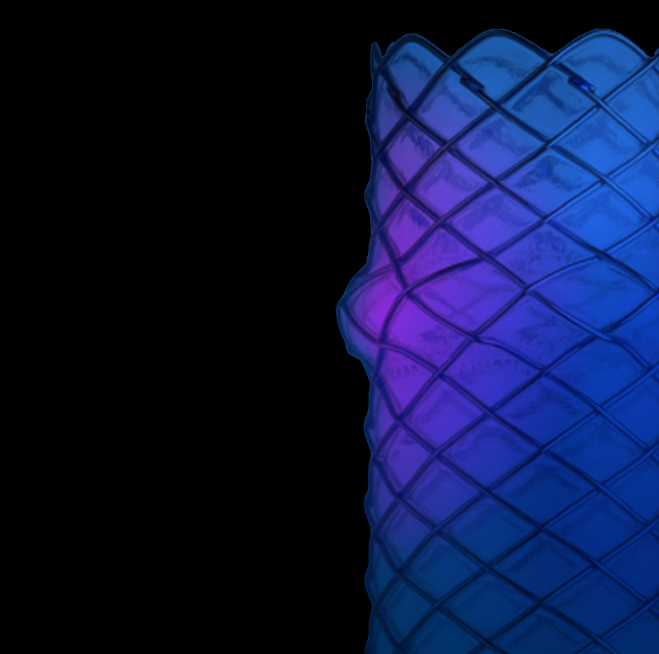 WallFlex Biliary PLUS Metal Stent with a highlighted anti-migration bump.