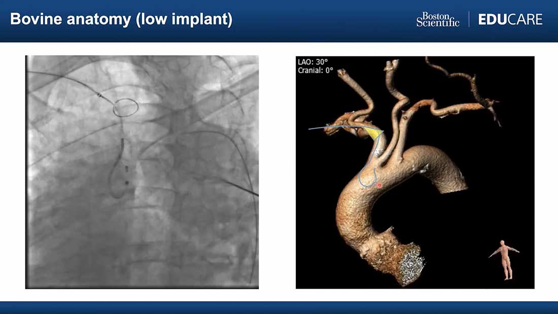 SENTINEL Training Module 3 Thumbnail