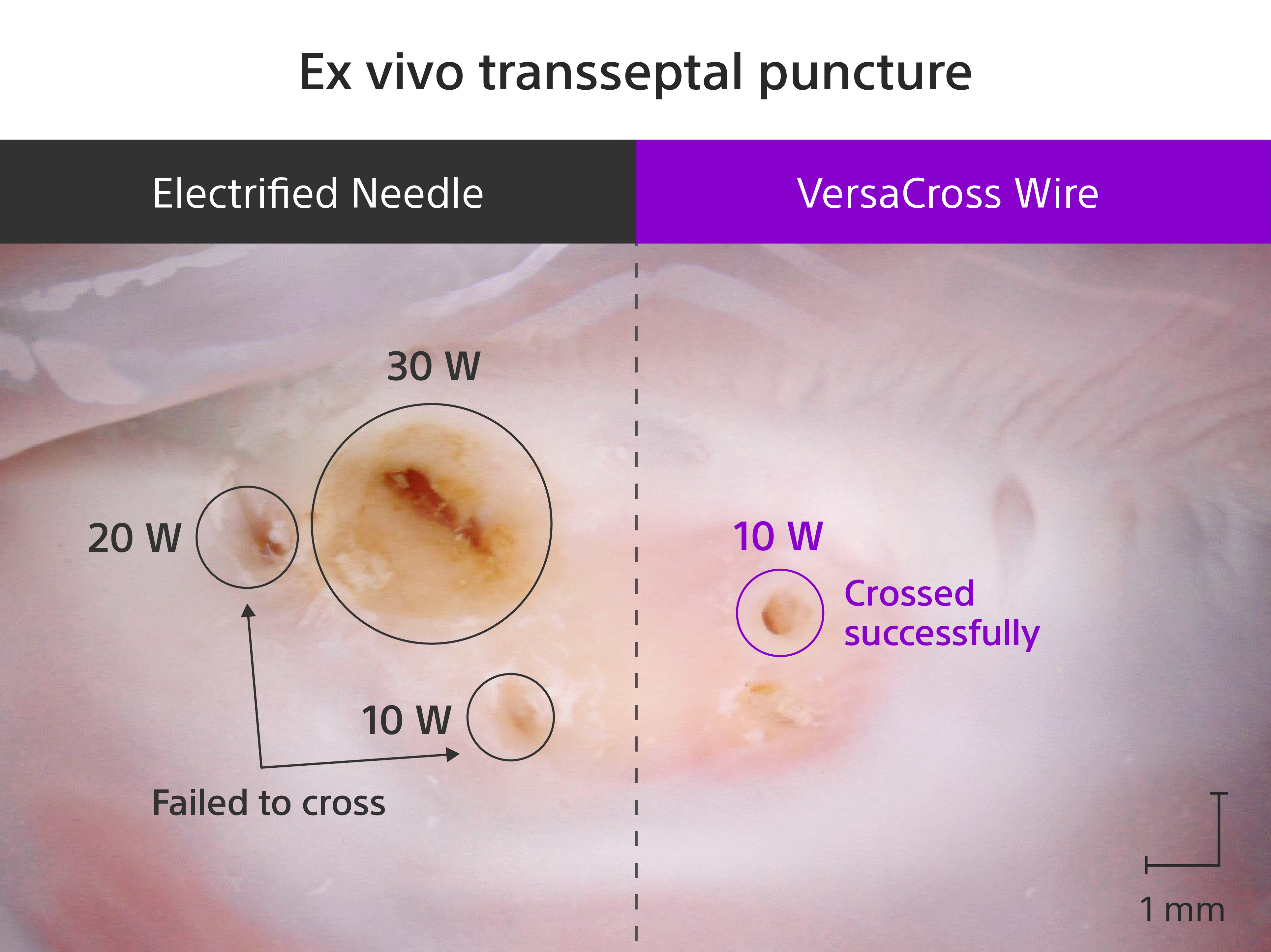 Comparing ex vivo transseptal puncture sites utilising an electrified needle at 10W, 20W, and 30W, to a successful puncture site utilising the VersaCross Wire at 10W.