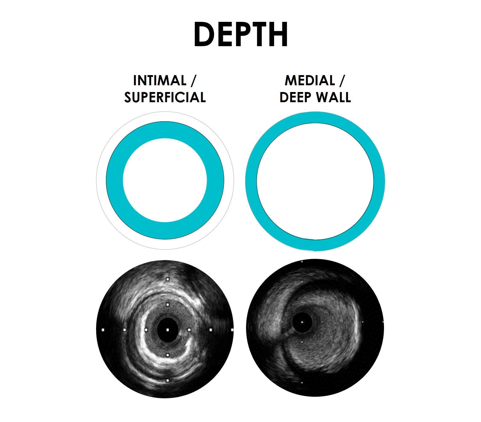 DEPTH