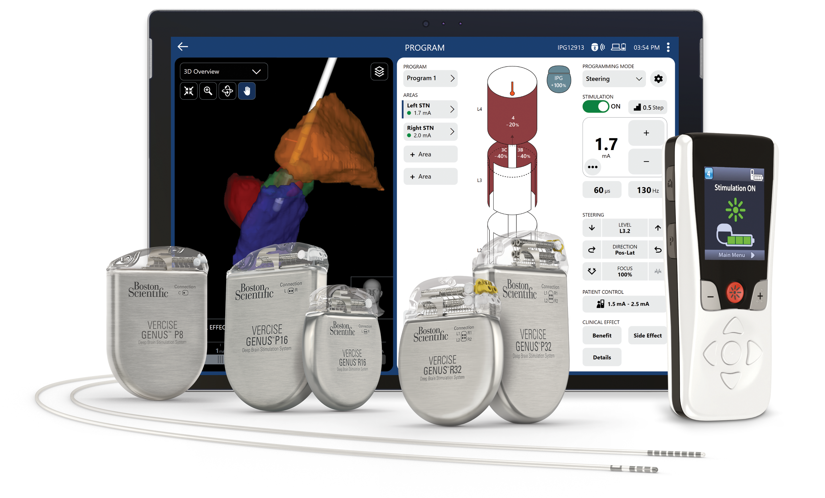Vercise Genus IPGs leads remote tablet vn5 software