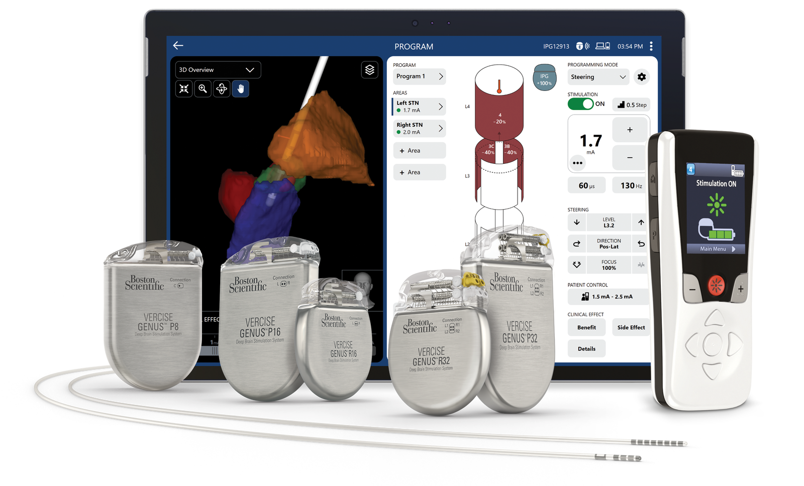 Vercise Genus Deep Brain Stimulation (DBS) System - Boston Scientific