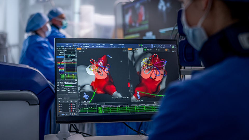 FARAVIEW™ software displayed on screen with OPAL HDx™ mapping system, showing real-time catheter position and cardiac electrical activity during ablation.