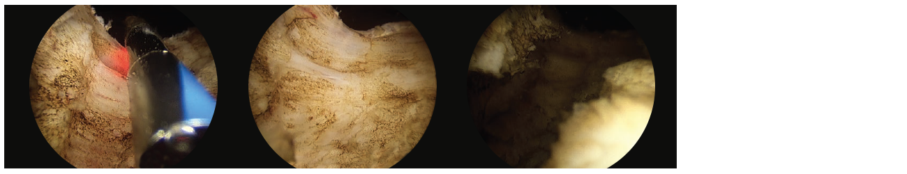 3 scope images. Identifying how to vaporize a working space.