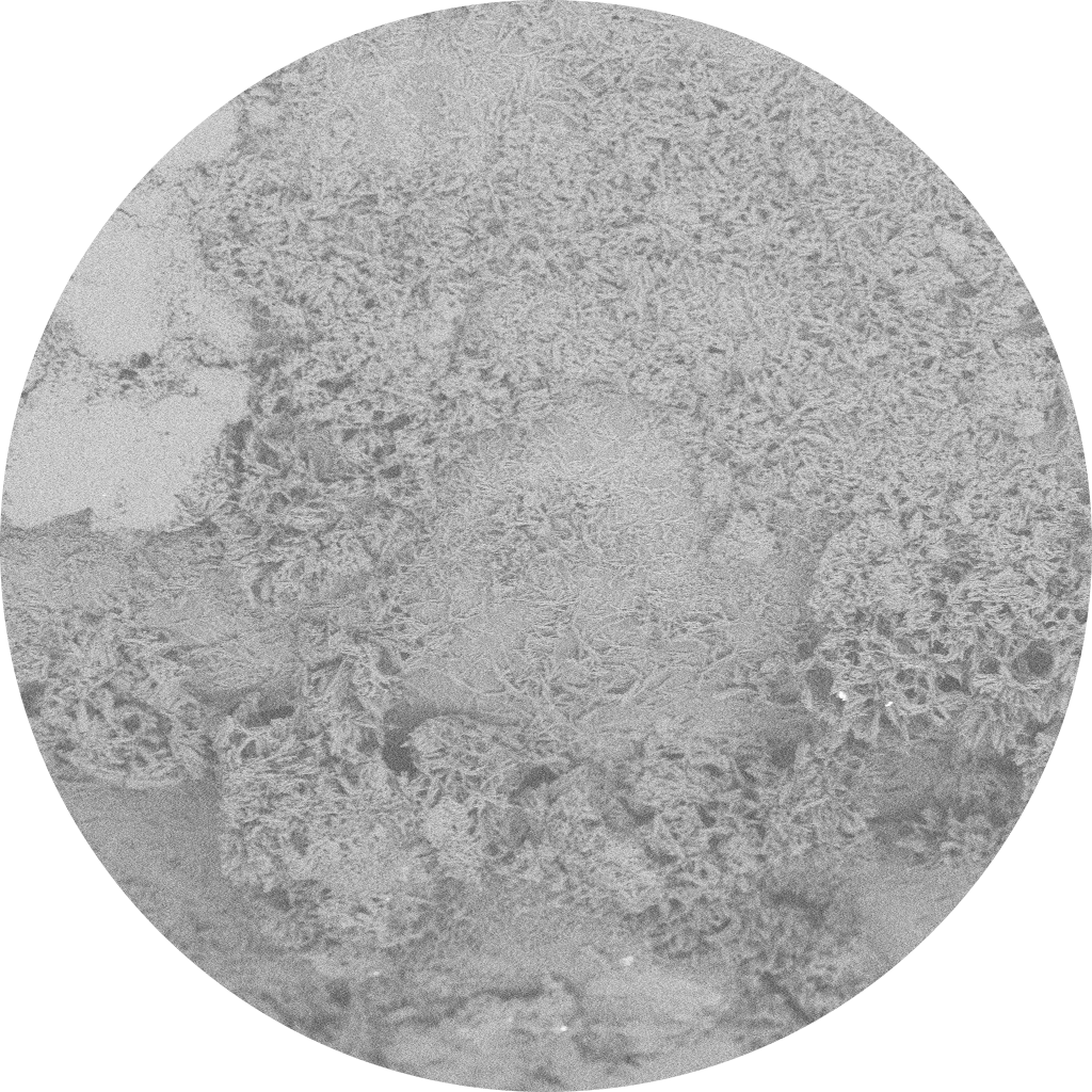 AGENT™ DCB Paclitaxel Drug post-tracking.