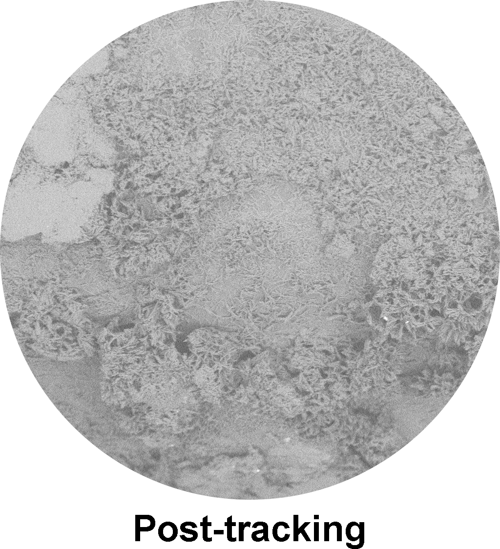 AGENT™ DCB Paclitaxel Drug post-tracking.