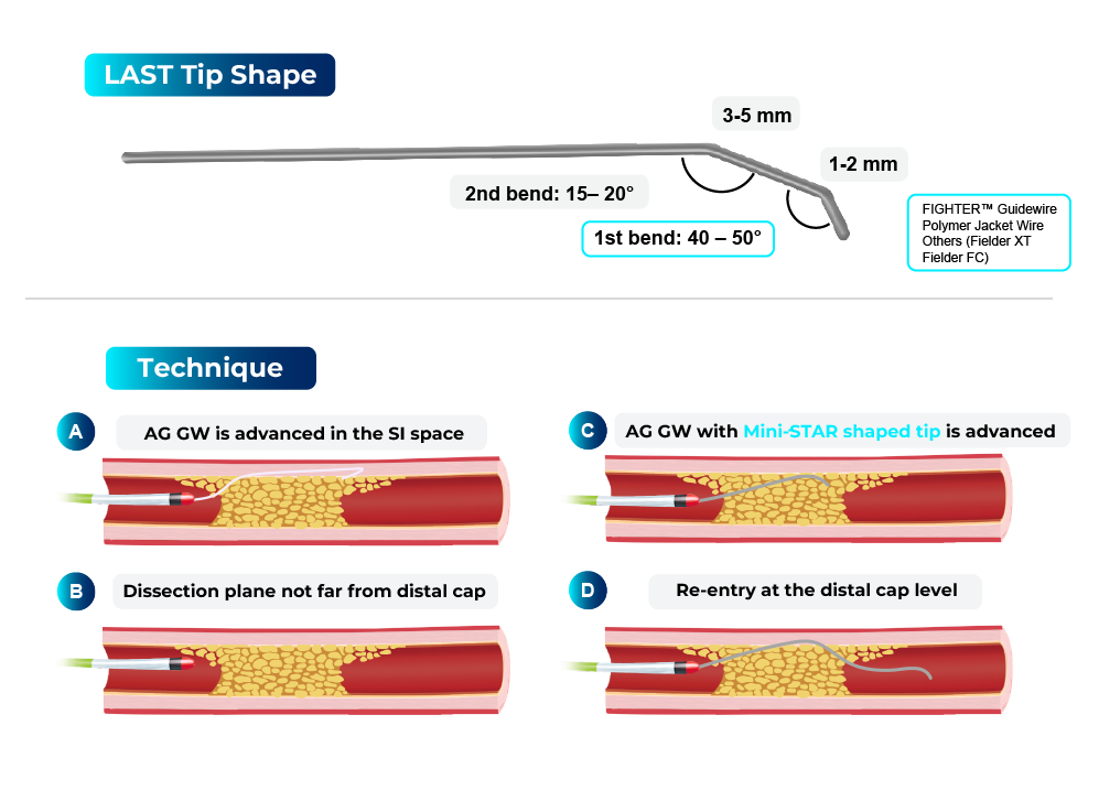 Fast-Spin CROSSBOSSTM Catheter Technique