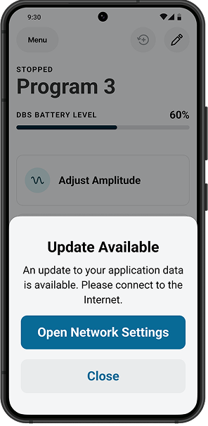 Vercise DBS controller provides update notices.
