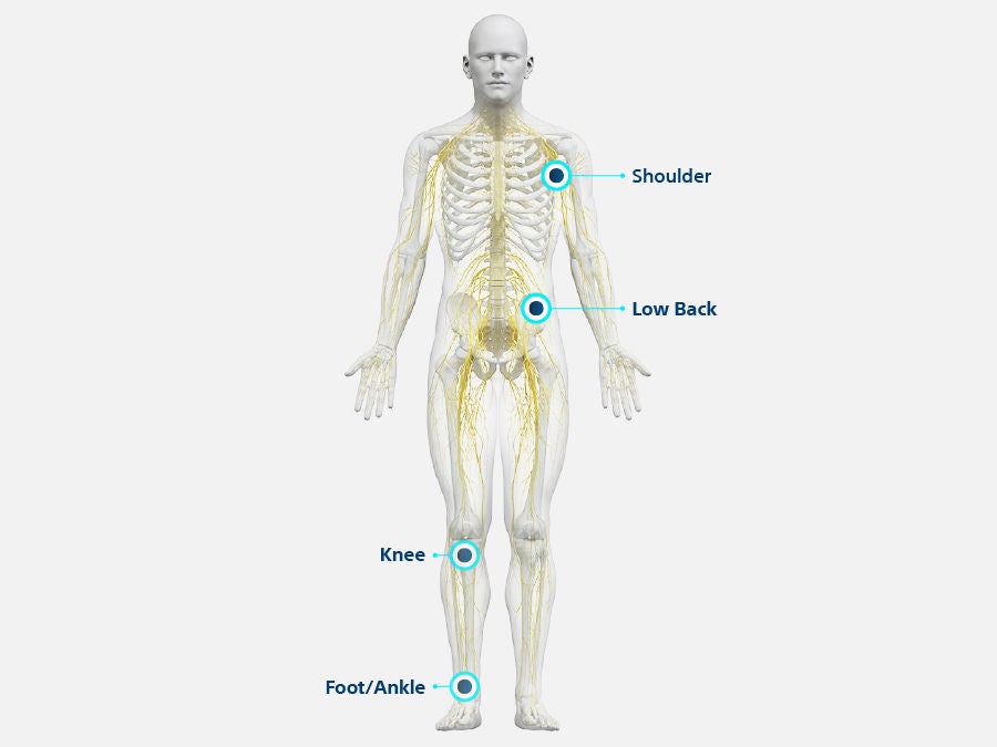 Illustration of a human figure with a highlighted nervous system with callouts to the shoulder, low back, knee, and foot or ankle.
