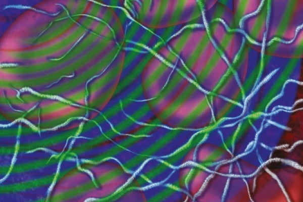 EKOS Drug reaching the thrombus and accelerates absorption