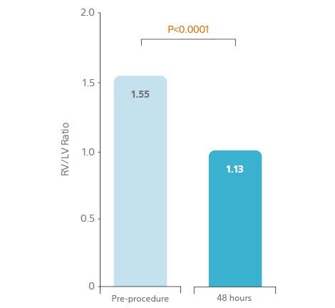 SEATTLE II trial 25% decrease in RV/LV ratio over 48h