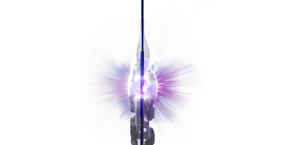 Image of peripheral SEISMIQ Intravascular Lithotripsy Catheter.