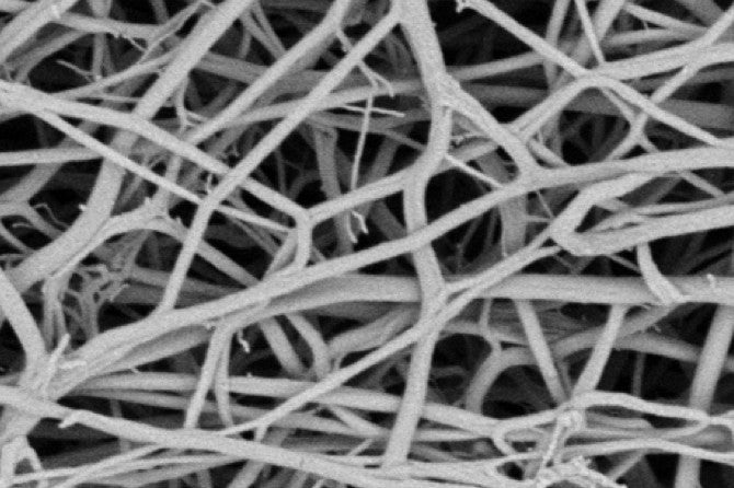 Fibrin no ultrasound before EKOS treatment