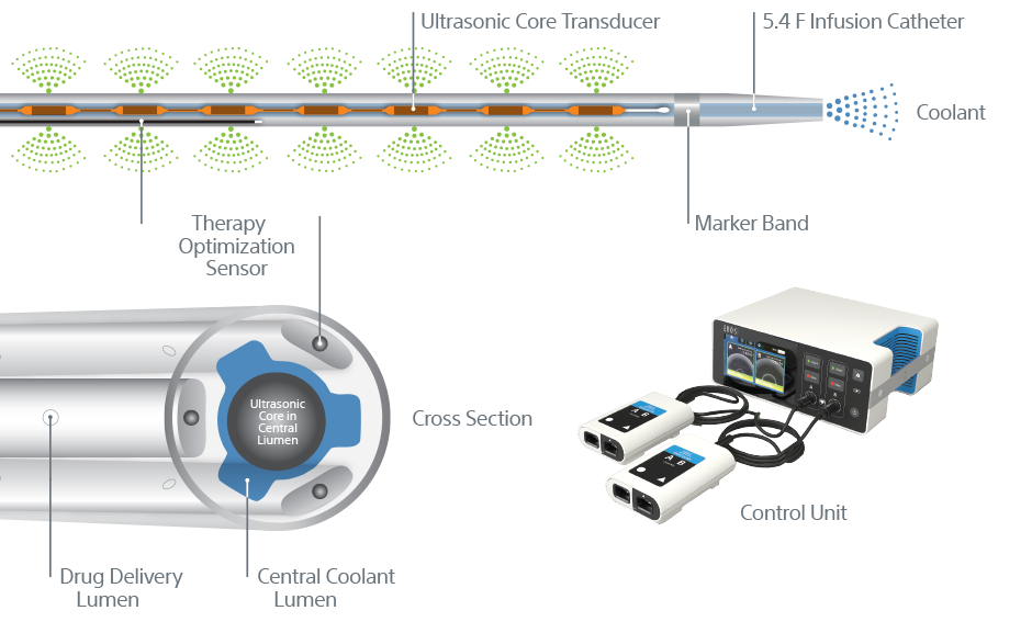EKOS systems for dissolving thrombus.