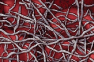 EKOS : Tighly wound fibrin strands prevent lytic from reaching receptor sites