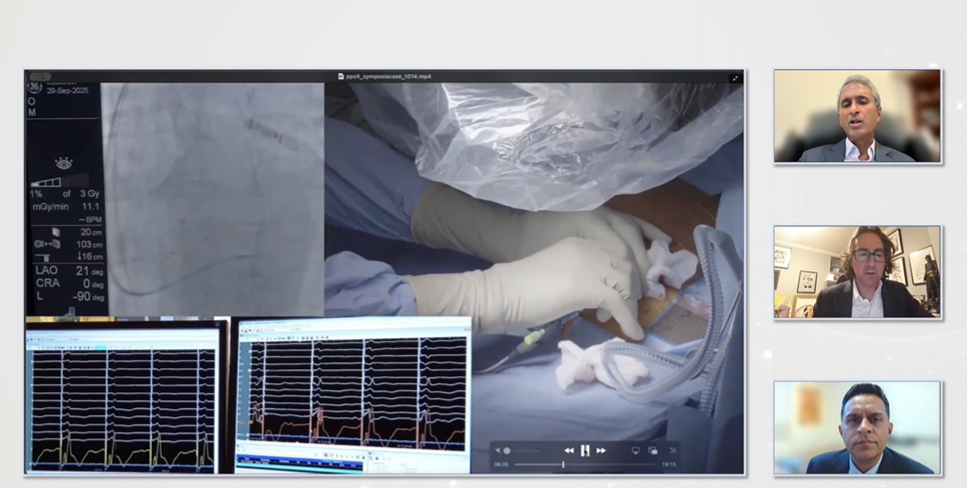 Live Conduction System Pacing case with fluoroscopy shared with an expert panel at PPS 2025.